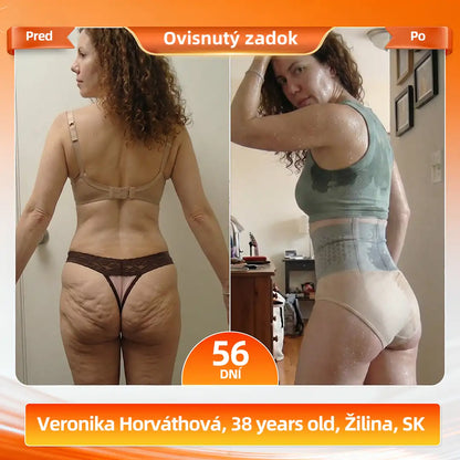 🇸🇰 | 𝐀𝐊𝐘𝐆𝐎® 𝟐𝟎𝟐𝟔 𝐌𝐨𝐫𝐢𝐧𝐠𝐚 x 𝐁𝐞𝐫𝐛𝐞𝐫𝐢𝐧𝐞 x 𝐍𝐀𝐃+ 𝟔-𝐯-𝟏 𝐌𝐢𝐤𝐫𝐨č𝐚𝐬𝐭𝐢𝐜𝐨𝐯é 𝐅𝐨𝐫𝐦𝐮𝐣ú𝐜𝐞 𝐚 𝐒𝐩𝐚ľ𝐮𝐣ú𝐜𝐞 𝐊𝐫á𝐭𝐤𝐞 𝐍𝐨𝐡𝐚𝐯𝐢𝐜𝐞 (Pre ženy aj mužov s podporou mužskej vitality)