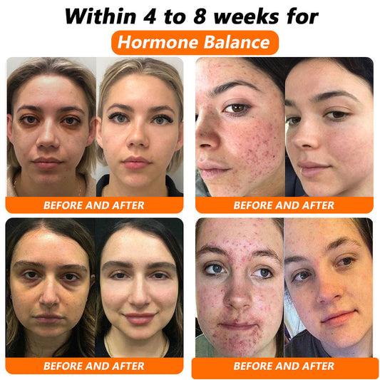 𝐂𝐯𝐫𝐞𝐨𝐳® ✨🌷𝐁𝐞𝐞 𝐕𝐞𝐧𝐨𝐦 𝐍𝐌𝐍 𝐍𝐚𝐭𝐮𝐫𝐚𝐥 𝐑𝐞𝐩𝐚𝐢𝐫 𝐕𝐚𝐠𝐢𝐧𝐚𝐥 𝐂𝐚𝐩𝐬𝐮𝐥𝐞𝐬 𝐅𝐨𝐫 𝐚𝐥𝐥 𝐯𝐚𝐠𝐢𝐧𝐚𝐥 𝐚𝐧𝐝 𝐡𝐨𝐫𝐦𝐨𝐧𝐚𝐥 𝐩𝐫𝐨𝐛𝐥𝐞𝐦𝐬☁️🍃